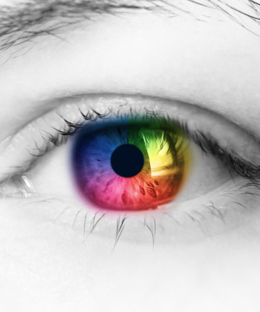 Keratopigmentation