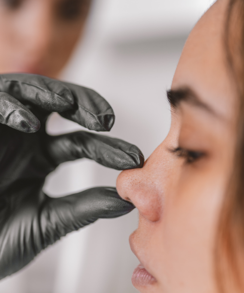 Rhinoplasty